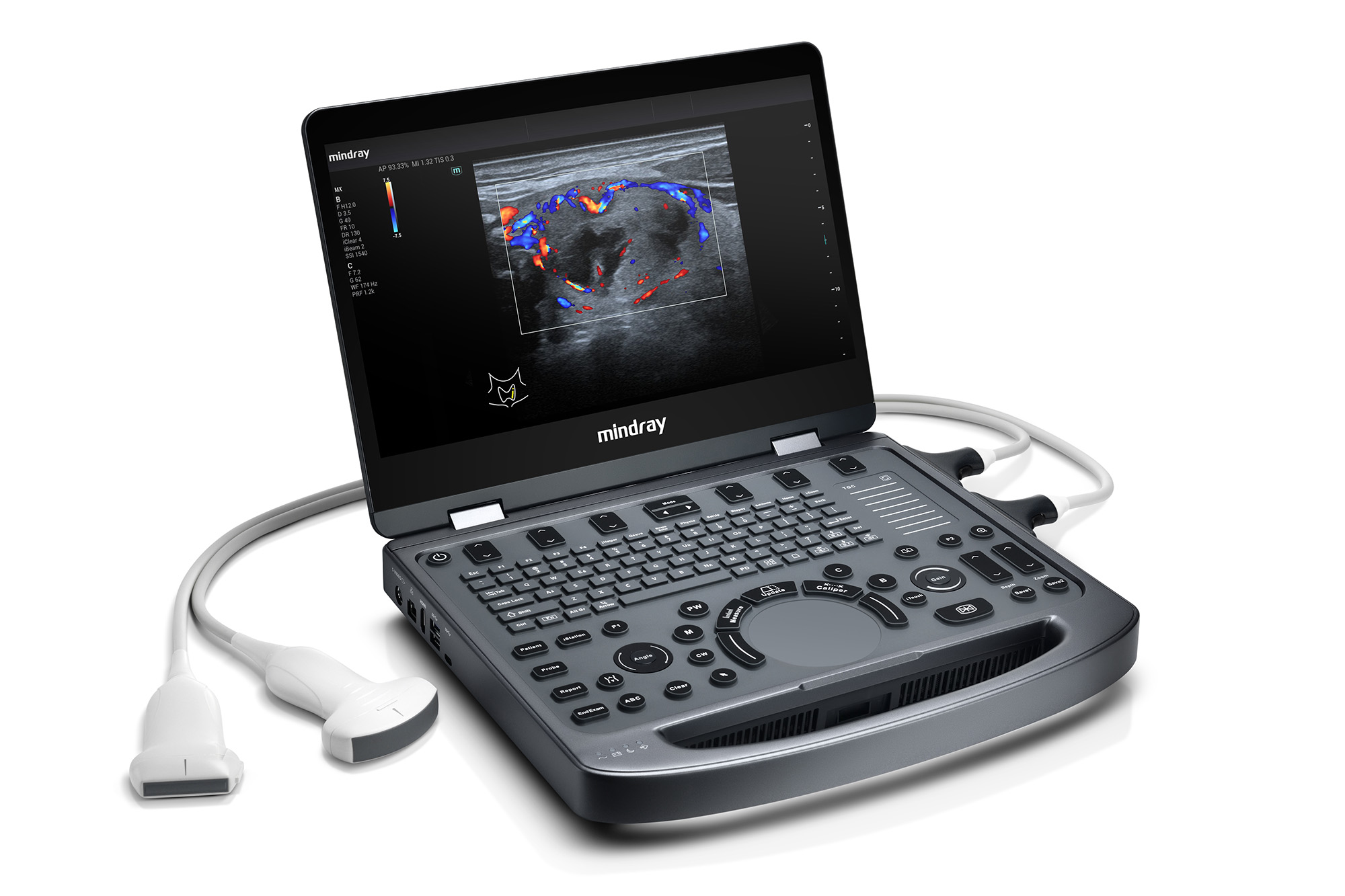 Mindray MX5 mx5 echo